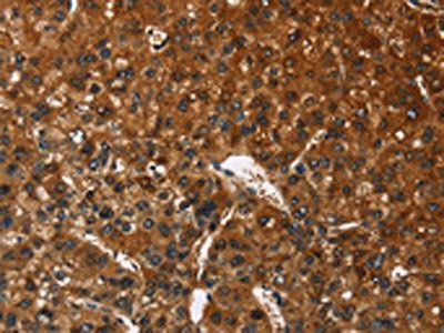 CATSPER4 Antibody