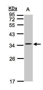 CYB5R1 antibody [N1C3]