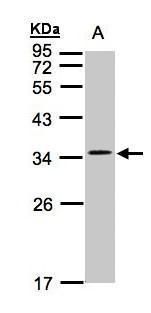 CYB5R1 antibody