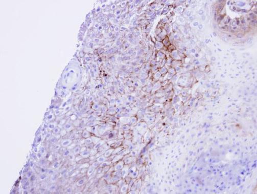 Cav1.1 Rabbit Polyclonal Antibody