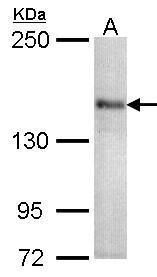 Cav1.1 Rabbit Polyclonal Antibody