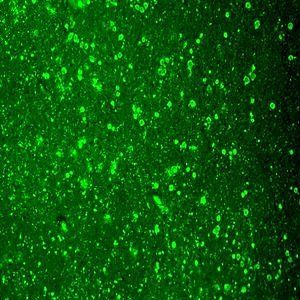 Cav1.2 Antibody