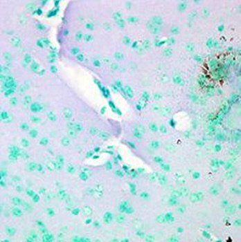 Cav1.2 Antibody