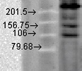 Cav1.2 Antibody