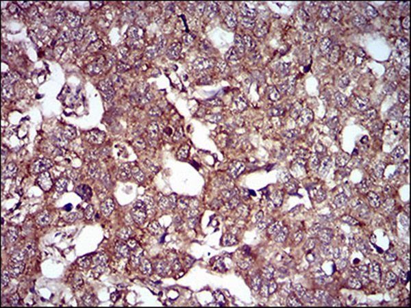 CAV2 Antibody