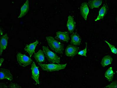 CAV2 antibody