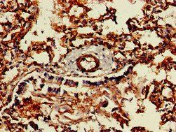 CAV2 antibody