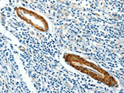 CAV3 Antibody