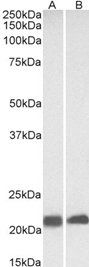 CAV3 antibody