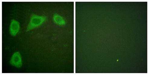 Caveolin-1 Antibody