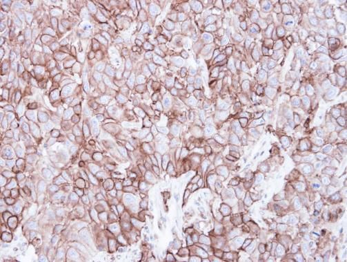 Caveolin 2 antibody