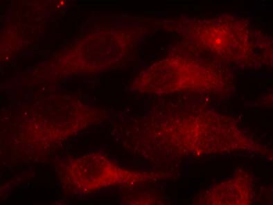 Caveolin (Phospho-Tyr14) Antibody