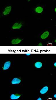 CBFA2T2 antibody