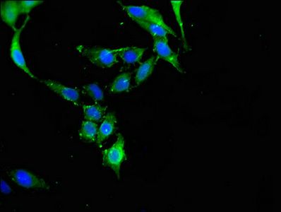CBL Antibody