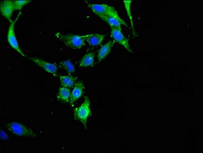 CBL antibody