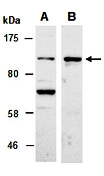 CBL (M) Antibody, Rabbit Polyclonal