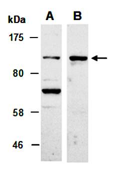 CBL (C) Antibody, Rabbit Polyclonal