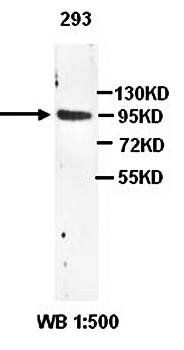 CBL Rabbit Polyclonal Antibody