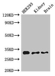 CBR1 antibody