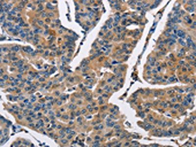 CBR1 Antibody