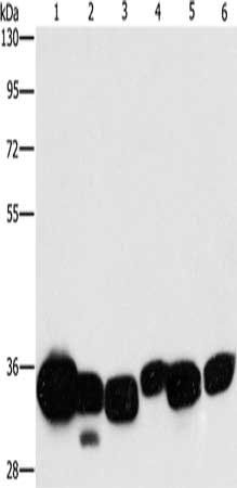 CBR1 antibody