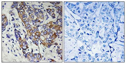 CBR1 Antibody