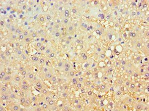 CBR3 Antibody