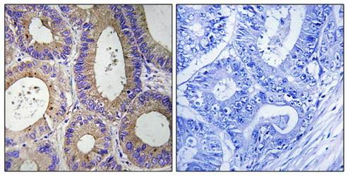CBR3 Antibody