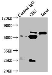 CBS antibody