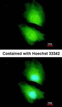 CBS Rabbit Polyclonal Antibody