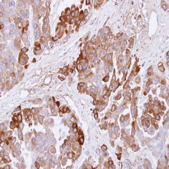 CBS Rabbit Polyclonal Antibody