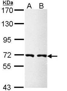 CBS Rabbit Polyclonal Antibody