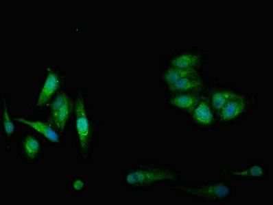 CBS Antibody