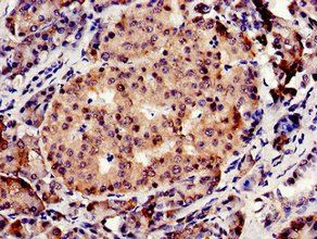 CBS Antibody
