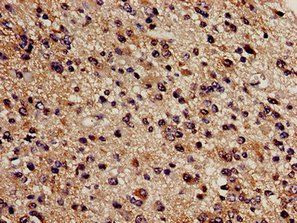 CBS Antibody