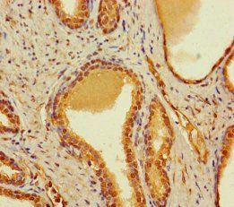 CBWD2 Antibody