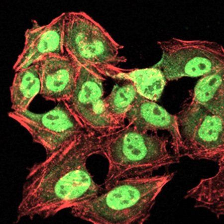 CBX1 Antibody