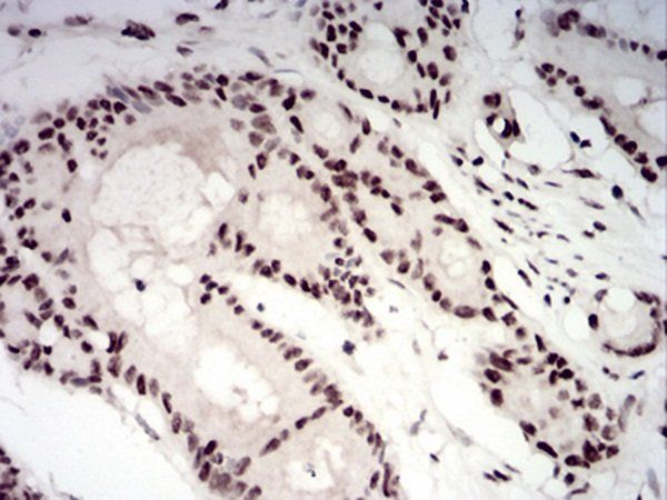 CBX1 Antibody