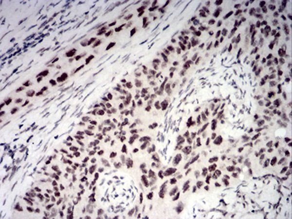 CBX1 Antibody