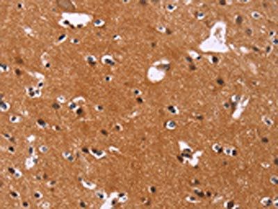 CBX3 Antibody