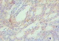 CBX4 Antibody