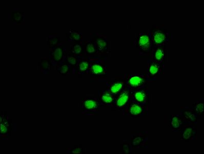 CBX4 Antibody