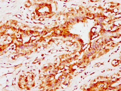 CBX4 Antibody
