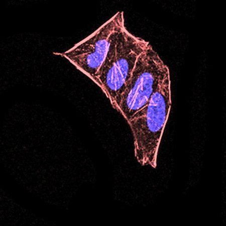 CBX5 Antibody