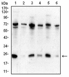 CBX5 Antibody