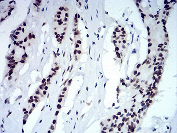 CBX5 Antibody