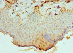 CBX8 Antibody