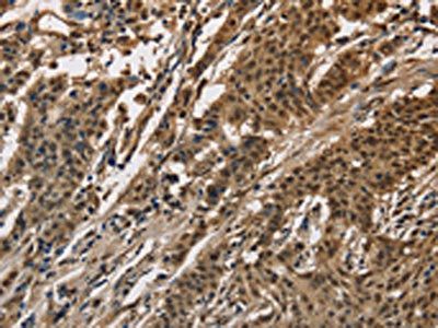 CCAR1 antibody