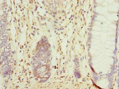CCDC106 Antibody