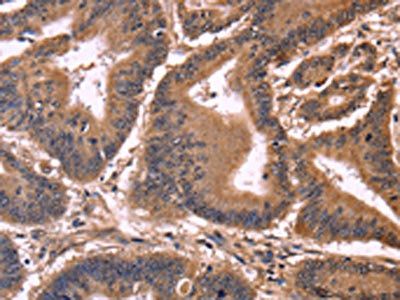 CCDC106 Antibody
